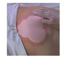 ALLEVYN SACRUM 10MED.ADES22X22CM