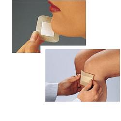 LOHMANN CURAPLAST SENS. 6CMX5M